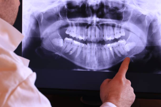 Best Knocked-Out Tooth Emergency  in New Mford, IL